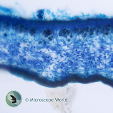Lichens under the microscope.