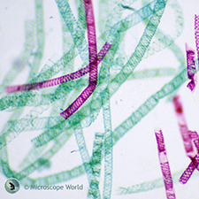 Spirogyra under the microscope.