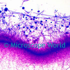 Aspergillus Microscope Image