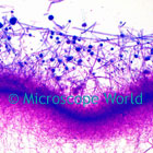 aspergillus microscope image
