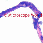 Diatom Microscope Image
