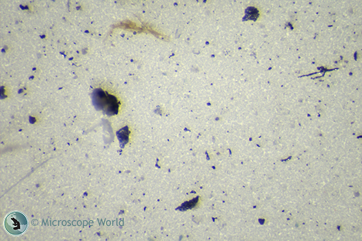 Filter patch inspection microscope image. Filter patch inspection microscope image.