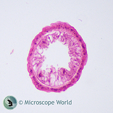 Hydra c.s. prepared slide  Hydra Under Microscope