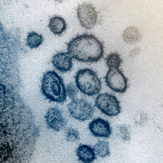 Virus that Causes COVID-19 Under the Transmission Electron Microscope Virus that Causes COVID-19 Under the Transmission Electron Microscope