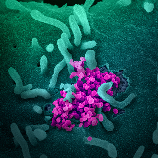 Scanning Electron Image of Coronavirus that causes COVID-19. Scanning Electron Image of Coronavirus that causes COVID-19.