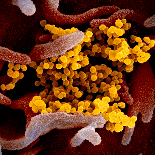 Scanning Electron Microscope Image of the virus that causes COVID-19. Scanning Electron Microscope Image of the virus that causes COVID-19.