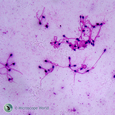 Human Sperm prepared slide under the microscope Human Sperm under the microscope