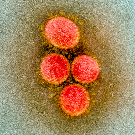 Transmission Electron Microscope image of SARS-CoV-2 Virus Transmission Electron Microscope image of SARS-CoV-2 Virus