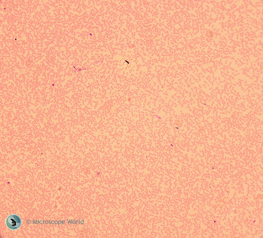 Blood cells under the microscope at 100x. Blood cells under the microscope at 100x.