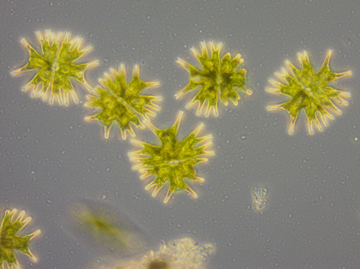 Micrasterias Radiata captured under Zeiss Primovert Micrasterias Radiata