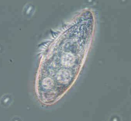 Free-Swimming Ciliate under Microscope in Wastewater Free-Swimming Ciliate under microscope