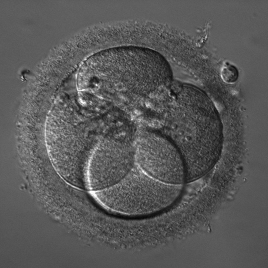 Embry captured under the Zeiss AxioVer A1 microscope using iHMC contrast. iHMC miroscope image of an embryo.