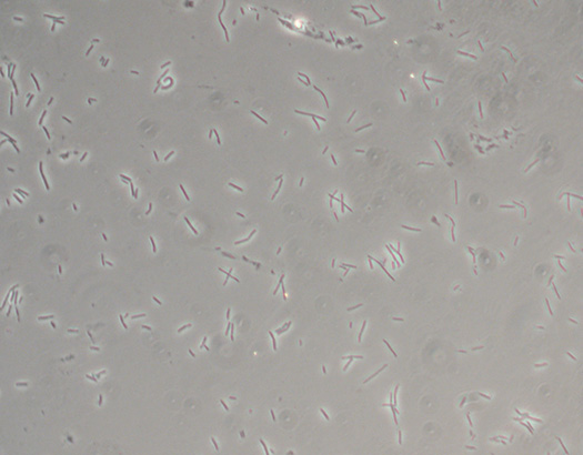 Bacteria under Phase Contrast Microscope Bacteria under Phase Contrast Microscope