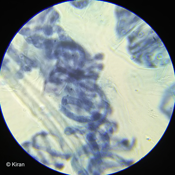 Spirogyra Algae Under the Microscope 100x Spirogyra Algae Under the Microscope 100x