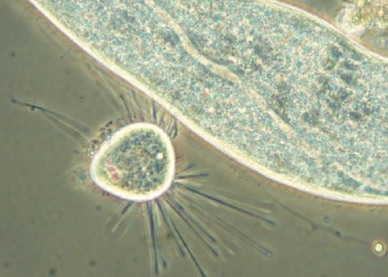 Suctorian under the Microscope Suctorian under the Microscope